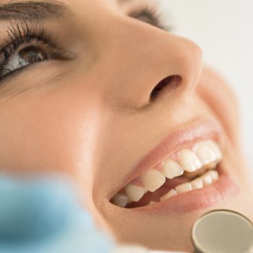 Tooth Mousse fogzománc védő kezelés