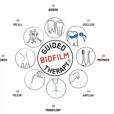How does Guided Biofilm Therapy (GBT) work?
